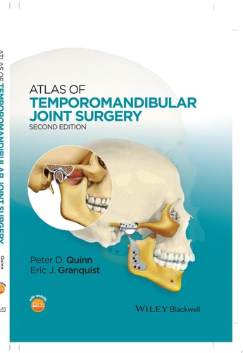 Atlas of Temporomandibular Joint Surgery